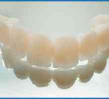 Пластмасови коронки на предните зъби, ревюта, цена